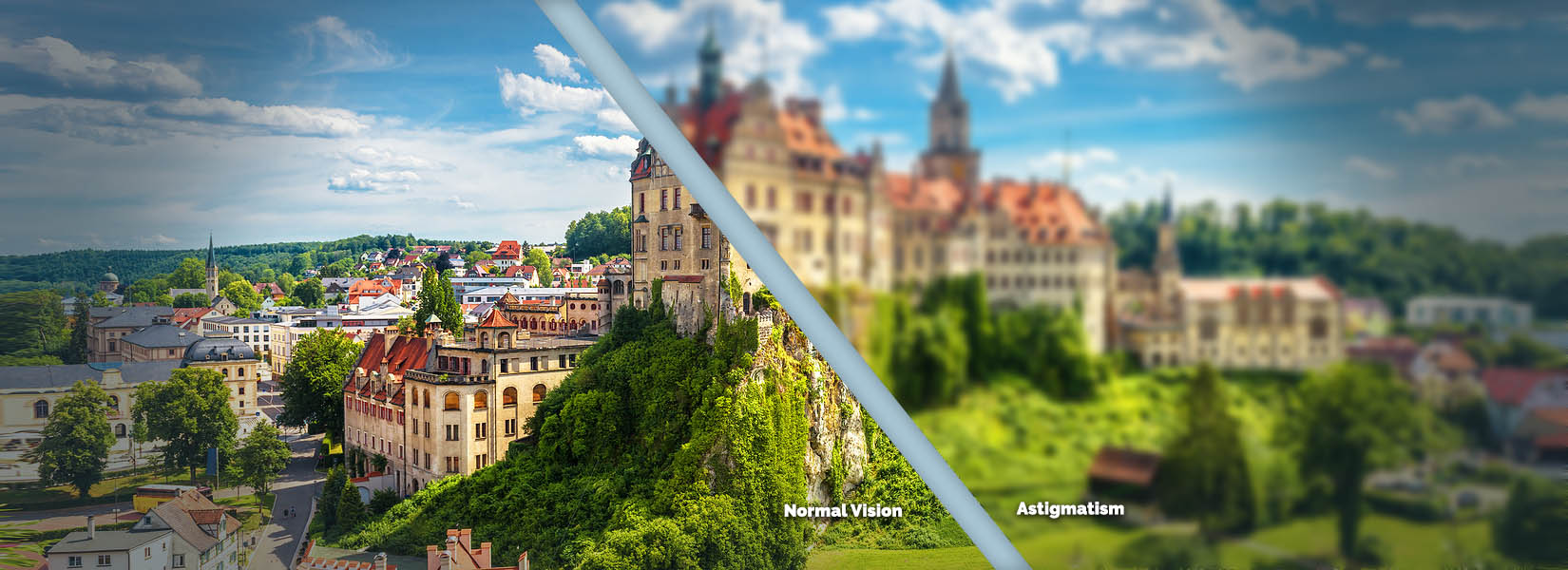 Astigmatism Treatment in Lima