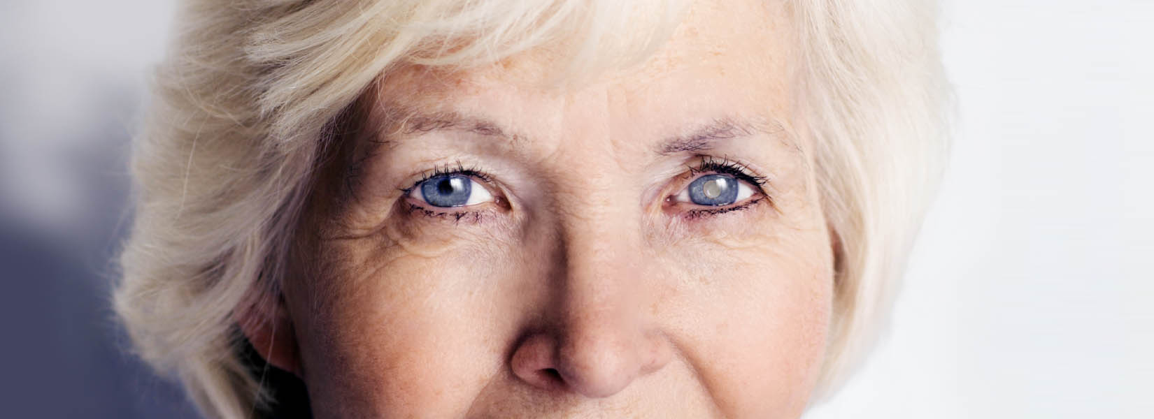 Cataract Surgery in Lima