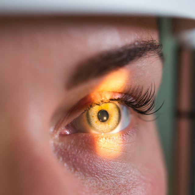 Vision Therapy in Lima